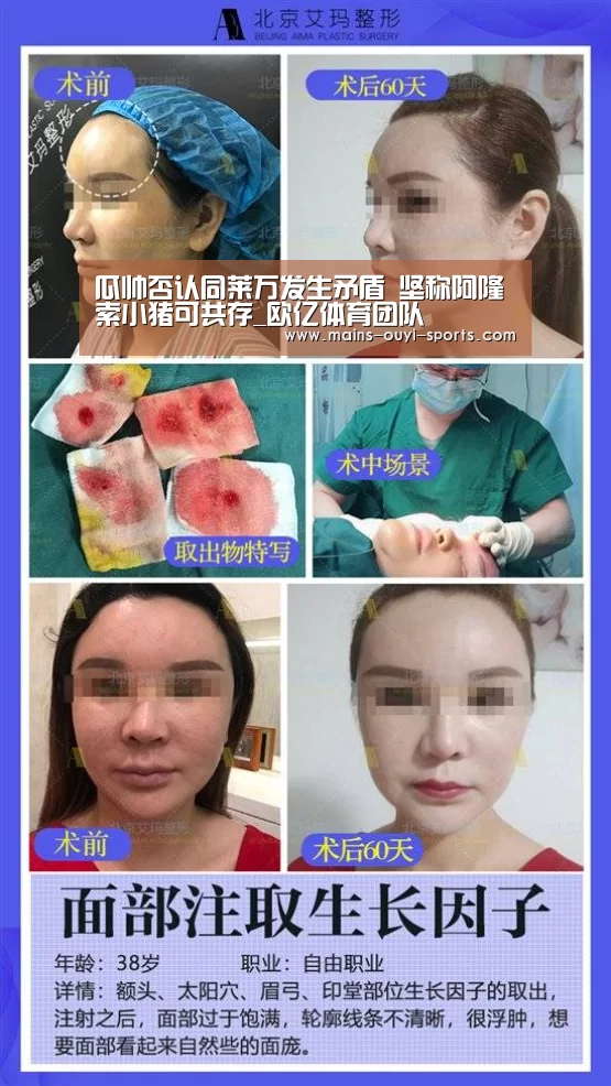 瓜帅否认同莱万发生矛盾 坚称阿隆索小猪可共存_欧亿体育团队(图1) 欧亿体育团队